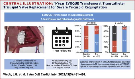 Transcatheter Tricuspid Valve Replacement With The Evoque System 1
