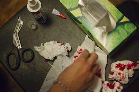 Failure to get vaccinated or to keep up to date with booster shots against tetanus 2. How to Tell If Your Cut or Scab Is Infected (Signs of ...