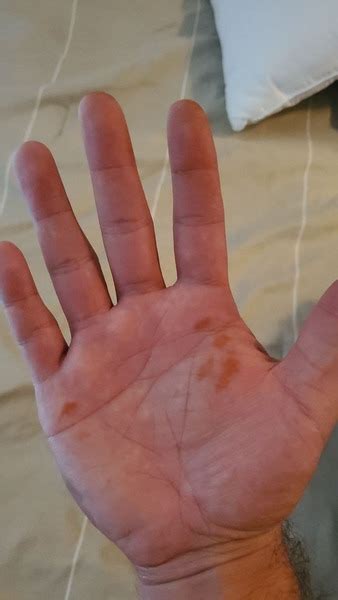 Rust Colored Stains On Hands Overnight Asking List