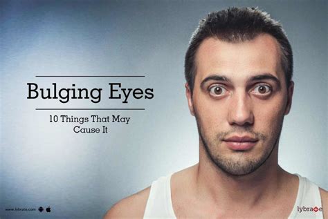 Bulging Eyes 10 Things That May Cause It By Dr Vaibhev Mittal