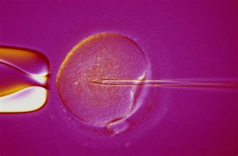 Ivf A Look At The In Vitro Fertilisation Process Huffpost Uk