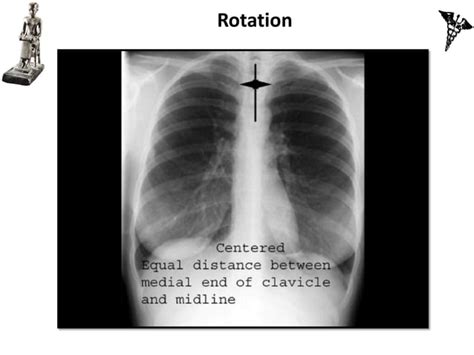 Basic Cxr Interpretationdiagnostic Radiography