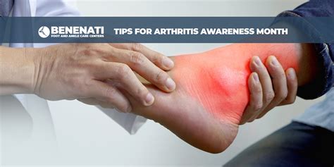 Tips For Arthritis Awareness Month Benenati Foot And Ankle Care Centers