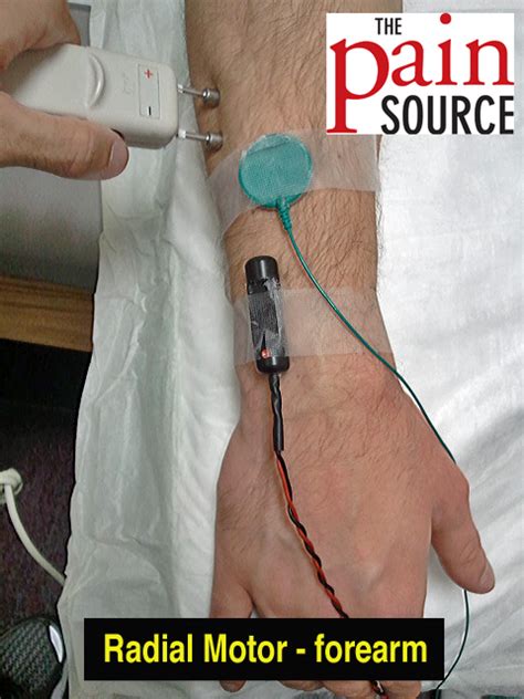 Setup Radial Motor Ncs The Pain Source Makes Learning About Pain
