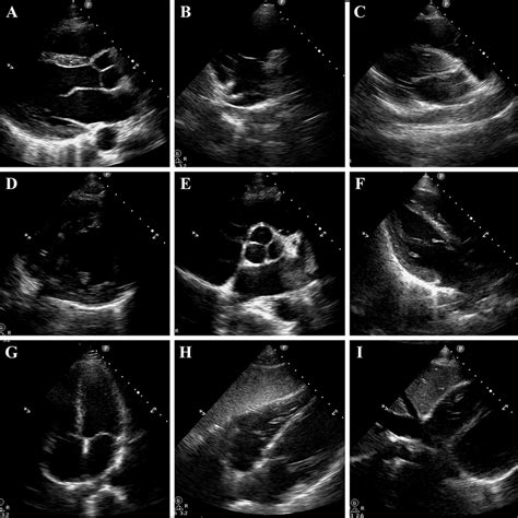 Examples Of 9 Of The 11 Standard Transthoracic Echocardiographic Views