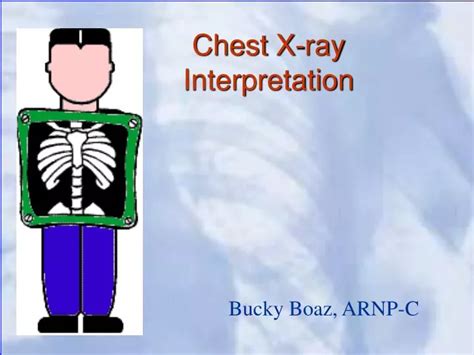 Ppt Chest X Ray Interpretation Powerpoint Presentation Free Download