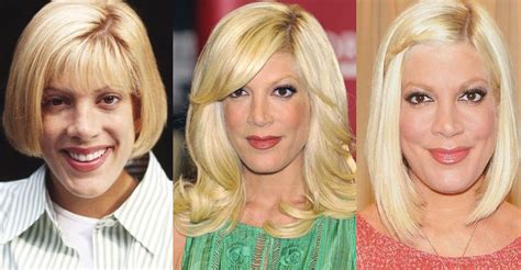 Tori Spelling Plastic Surgery Before And After Pictures 2024