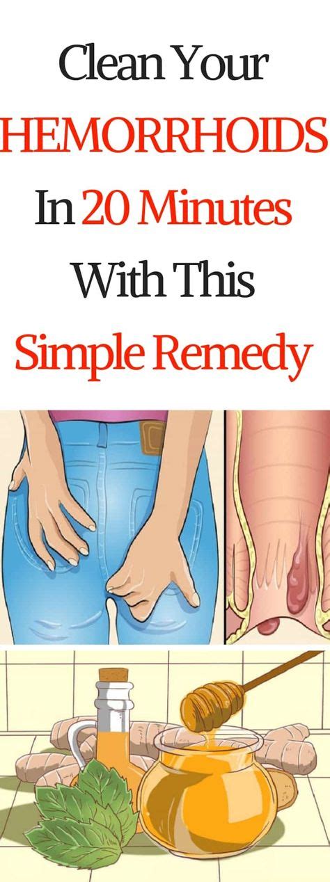 Clean Your Hemorrhoids In Just 20 Minutes With This Simple Remedy