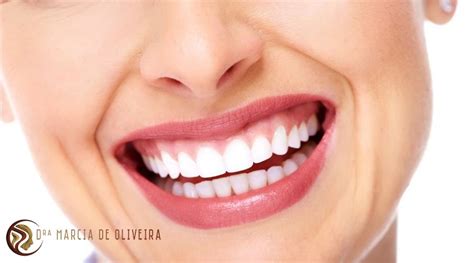 Apinhamento Dental Clínica Odontológica Em Copacabana Dentista Em