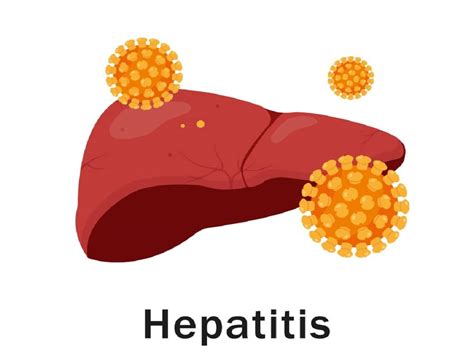 Breaking Down Autoimmune Hepatitis