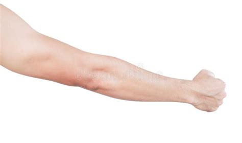 Man Arm With Blood Veins On White Background Health Care And Medical