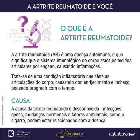 Conheça Os Sintomas Da Artrite Reumatoide Artrite Reumatoide