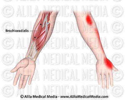 Alila Medical Media | Pain Management Images and Videos