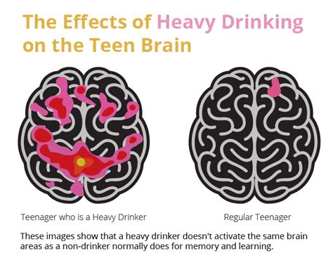 Effects Of Alcohol On The Body And Brain Rehab Guide Clinics