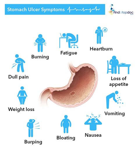 Stomach Ulcer Symptoms | Ulcer symptoms, Stomach ulcers symptoms ...