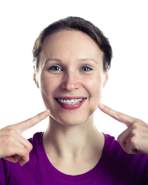 Beautiful Smiling Girl With Retainer For Teeth Stock Image Image Of