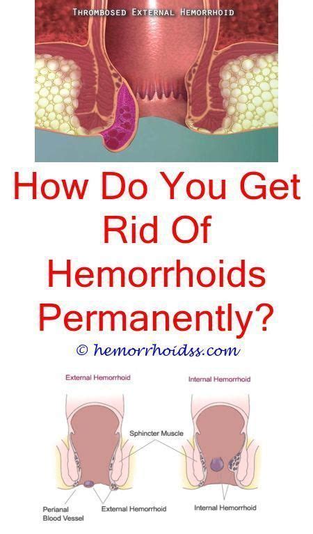 On average herpes outbreaks last anywhere from 2 to 3 weeks. Piles are normally not severe, but they can be irritating ...