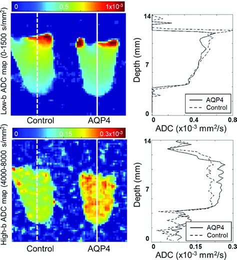 Apparent Diffusion Coefficient Adc Maps Calculated For A Low And High
