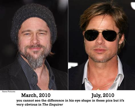 Brad Pitt Plastic Surgery Before And After Facelift And Nose Jobs Star