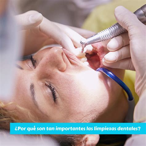 ¿por Qué Son Tan Importantes Las Limpiezas Dentales Odontología Caballito