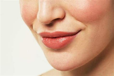 How To Get Rid Of Sun Burnt Lips Blisters Naturally