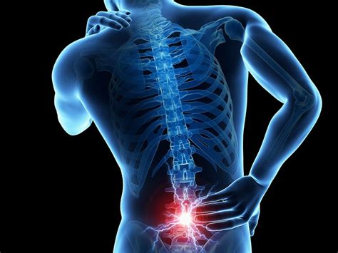 Lower Back Pain Dr Michael A Castillo Md