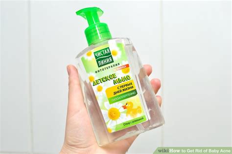 How To Get Rid Of Baby Acne 10 Steps With Pictures Wikihow