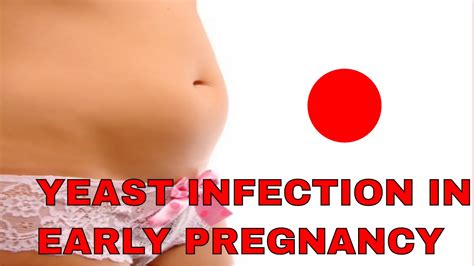 how do i avoid a yeast infection in early pregnancy get rid of yeast infection during
