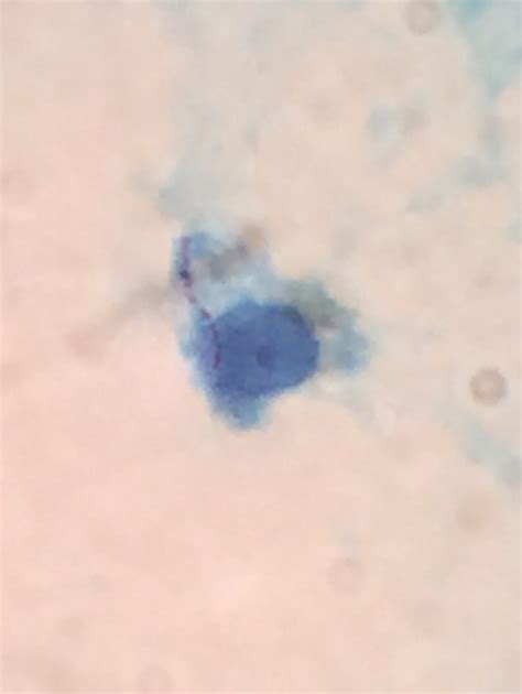 Mycobacterium Kansasii グラム染色 Gram Stain