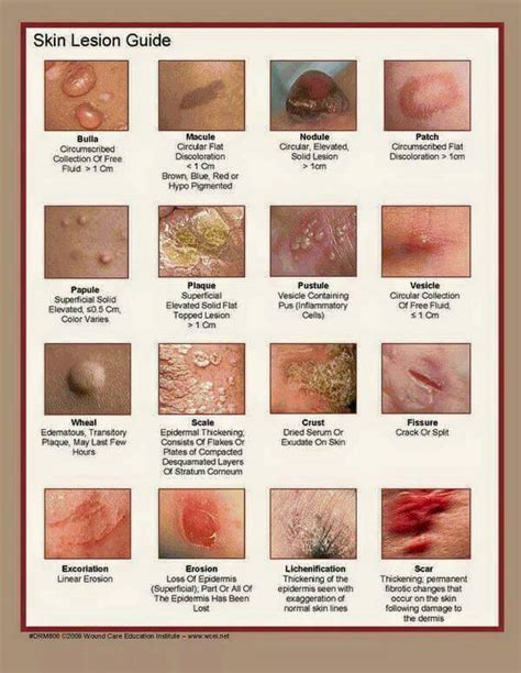 Medical Online Skin Lesion Guide Facebook
