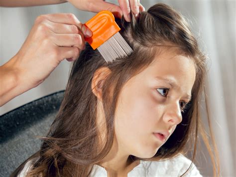 Easy Home Remedies To Get Rid Of Head Lice And Nits