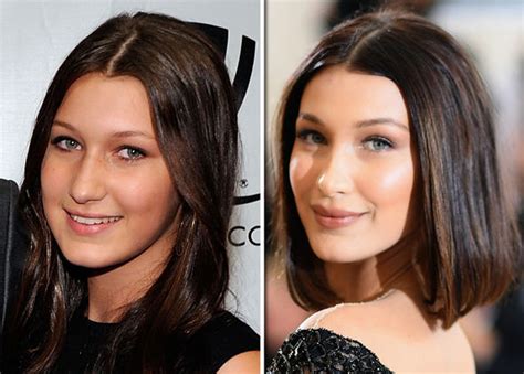 bella hadid before and after has she had surgery an expert weighs in uk