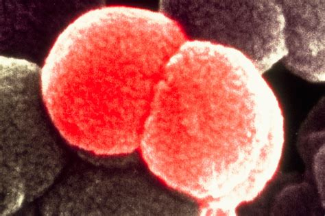 Meningitis Bacteria Neisserai Meningitidis Electron Micr Flickr
