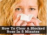 Pictures of Stuffy Nose Home Remedies For Toddlers