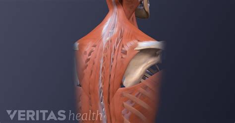 Back Rib Cage Muscles Ares Clinical Taping Intercostal Neuralgia