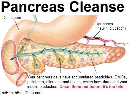 Find out what you can do to prevent or treat this disease in your pet. Pin by Ature on Detox | Pancreas health, Prevent diabetes ...