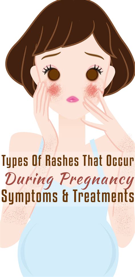 What Causes Skin Rashes During Pregnancy