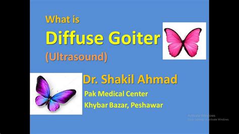 What Is Diffuse Goiter Ultrasound Features Youtube