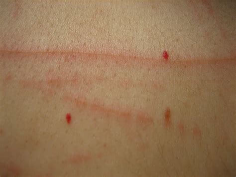 Scratched Skin Texture Cc0pd I G Flickr