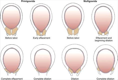 Cervix Dilation Chart Awesome Image Result For How Cervix Dilate