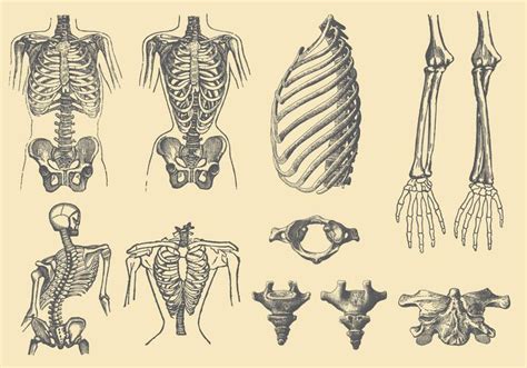 Human Bones And Deformations Vector Art Art Images Art