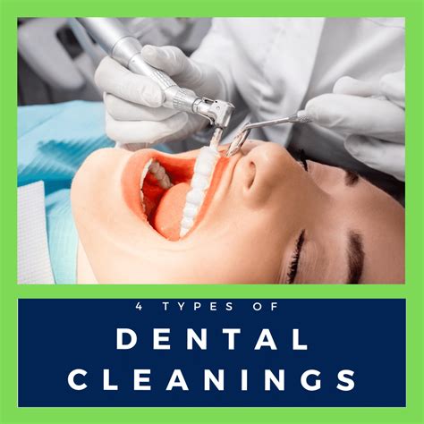 4 Types Of Dental Cleanings Needham Bedford Franklin Ma