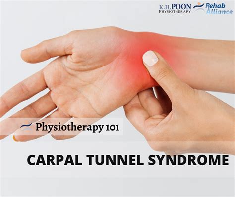 Physiotherapy 101 Carpal Tunnel Syndrome Cts Rehab Alliance