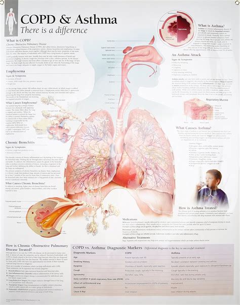 COPD Asthma Chart Laminated Wall Chart Scientific Publishing