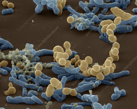 Coloured Sem Of Lactobacillus Bacteria Stock Image B2201093
