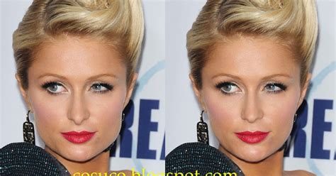 Cosmetic Surgery Connoisseur Paris Hilton With Minor Tweaks To Her