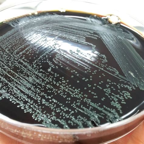 Listeria monocytogenes гидролизует эскулин на эскулетин и глюкозу. 리스테리아 모노사이토제네스 Oxford Agar배지, Listeria monocytogenes ...