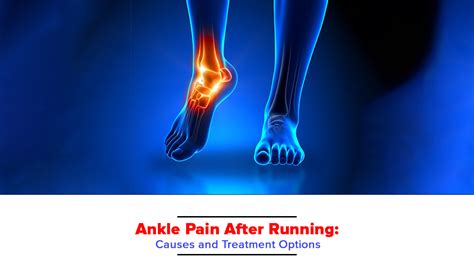 Ankle Pain After Running Causes And Treatment Options Bioflex Pakistan