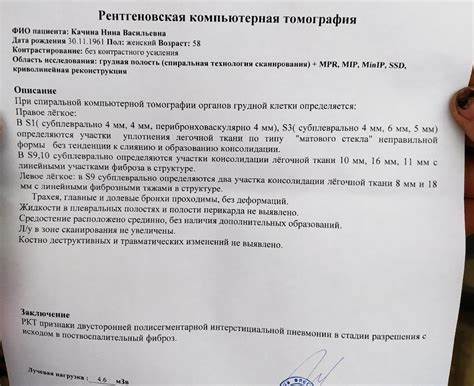 Диета при фиброзе 1 Диета При Фиброзе Легких — Похудение Диета Правильное Питание Диета При Фиброзе Легких — Похудение Диета Правильное Питание Диета при фиброзе 1