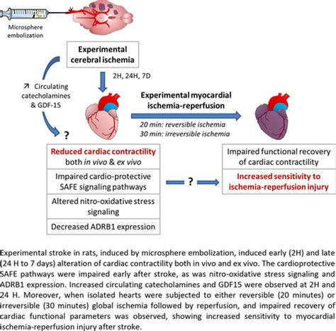 Ischemic Stroke Increases Heart Vulnerability To Ischemia Reperfusion